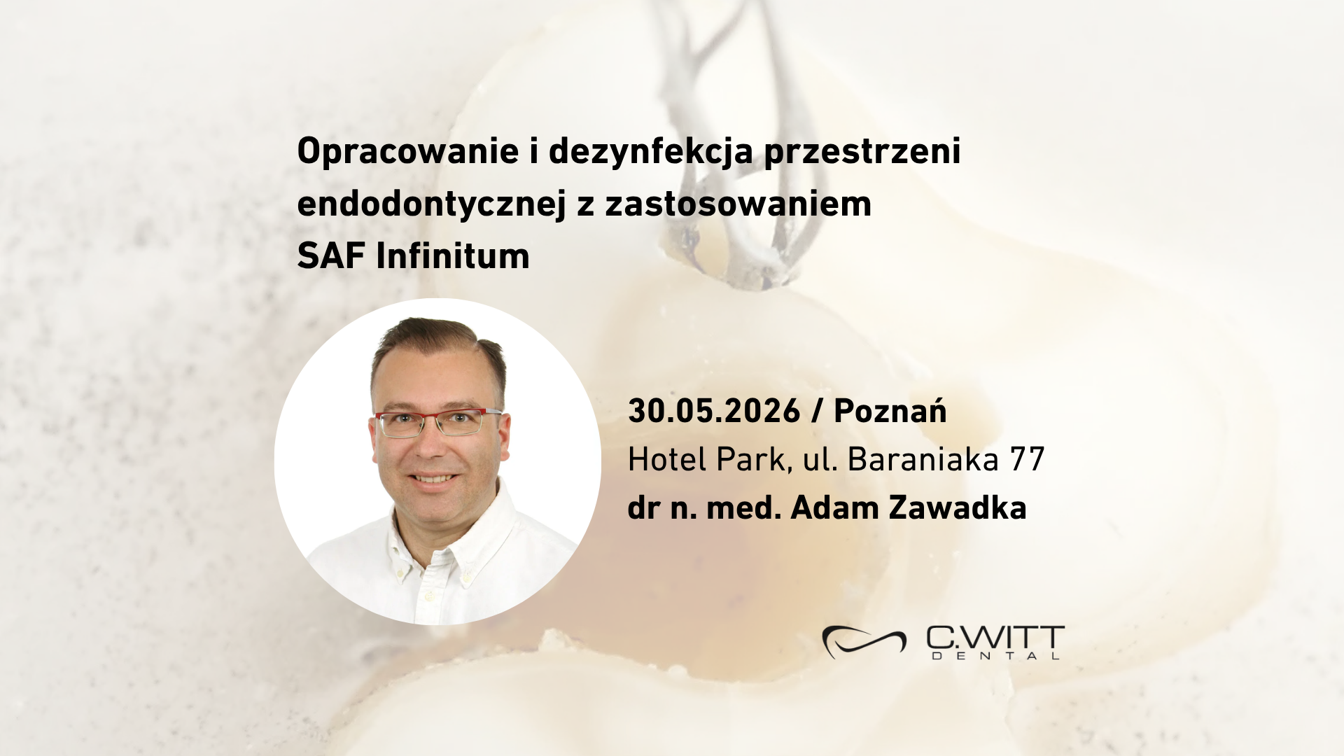 Opracowanie i dezynfekcja przestrzeni endodontycznej z zastosowaniem SAF Infinitum