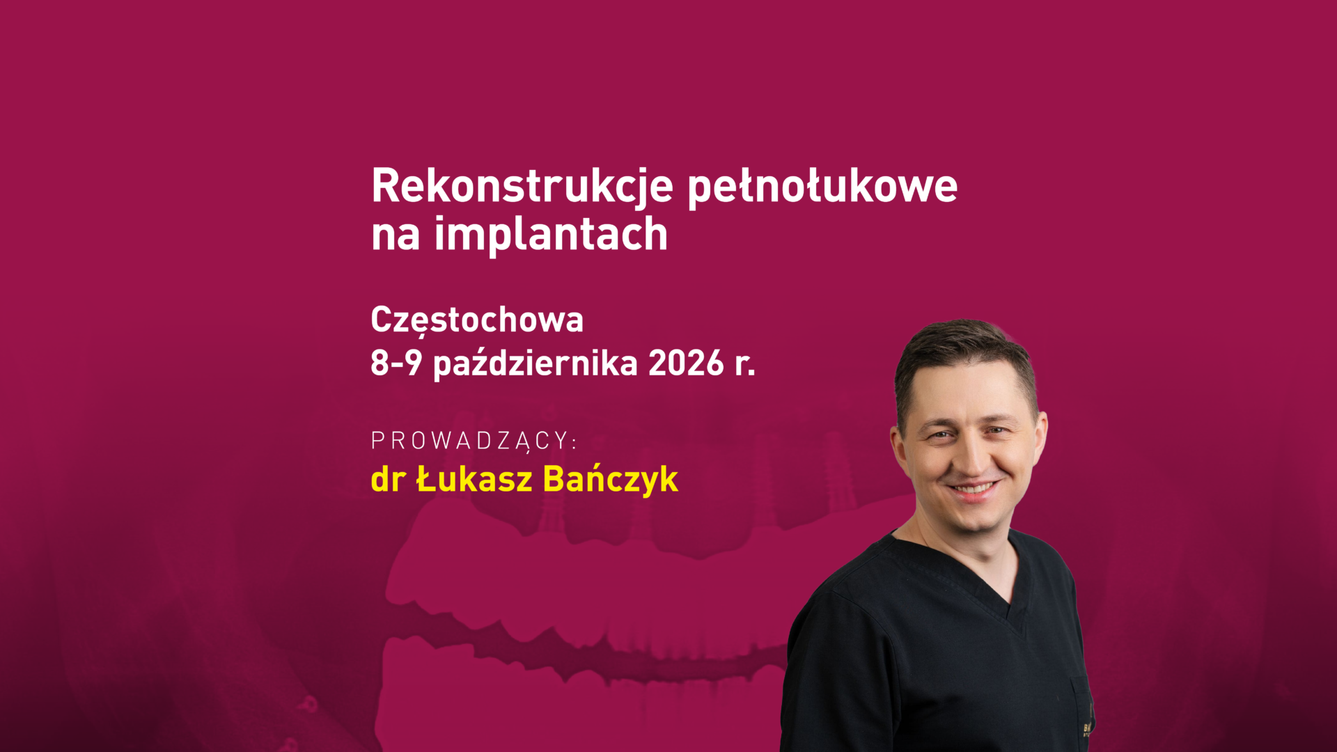 Rekonstrukcje pełnołukowe na implantach