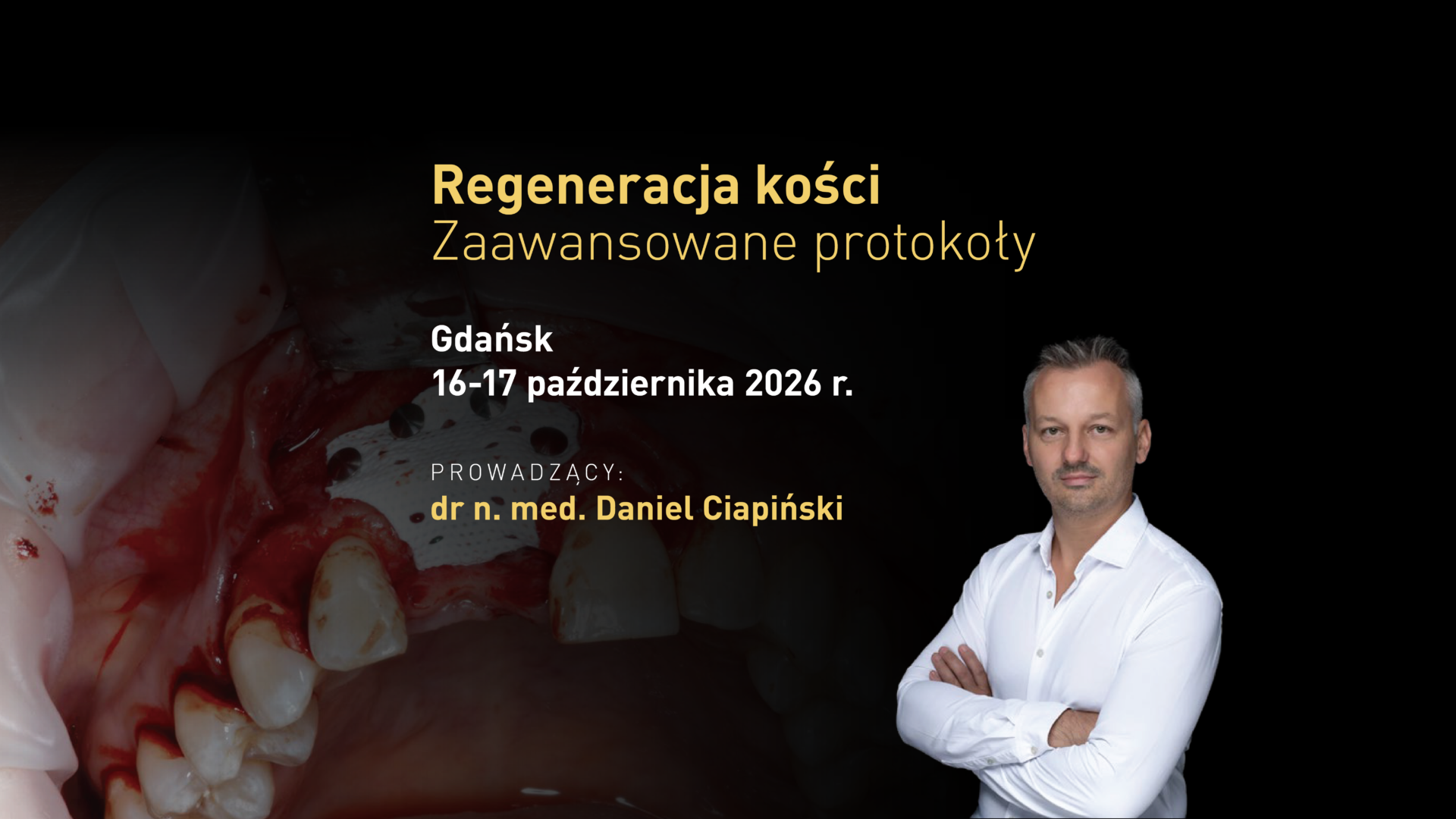 Regeneracja kości. Zaawansowane protokoły